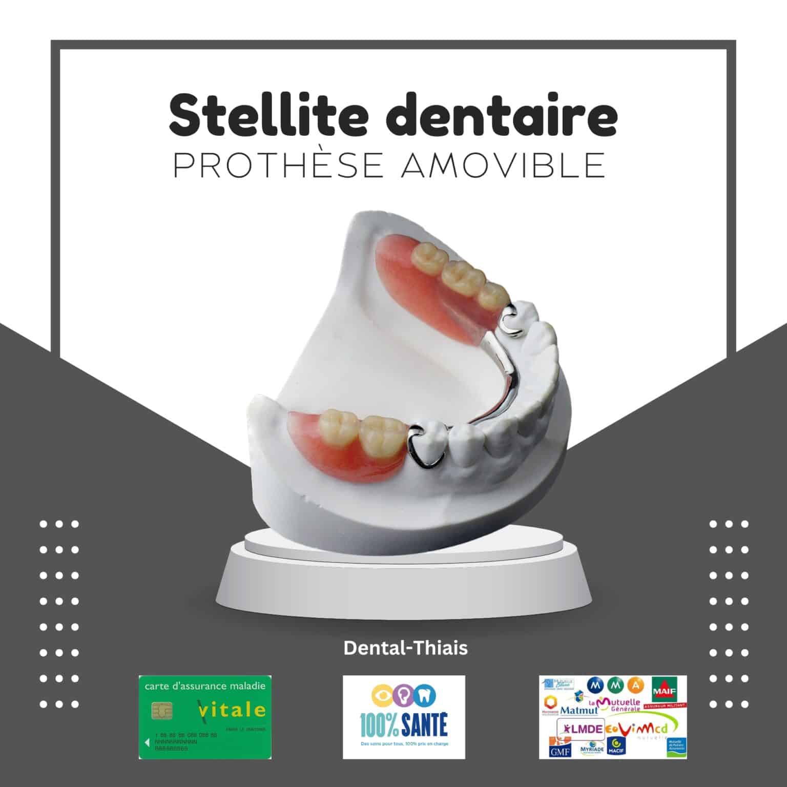 Stellite Dentaire Comprendre Et Choisir La Proth Se Adapt E