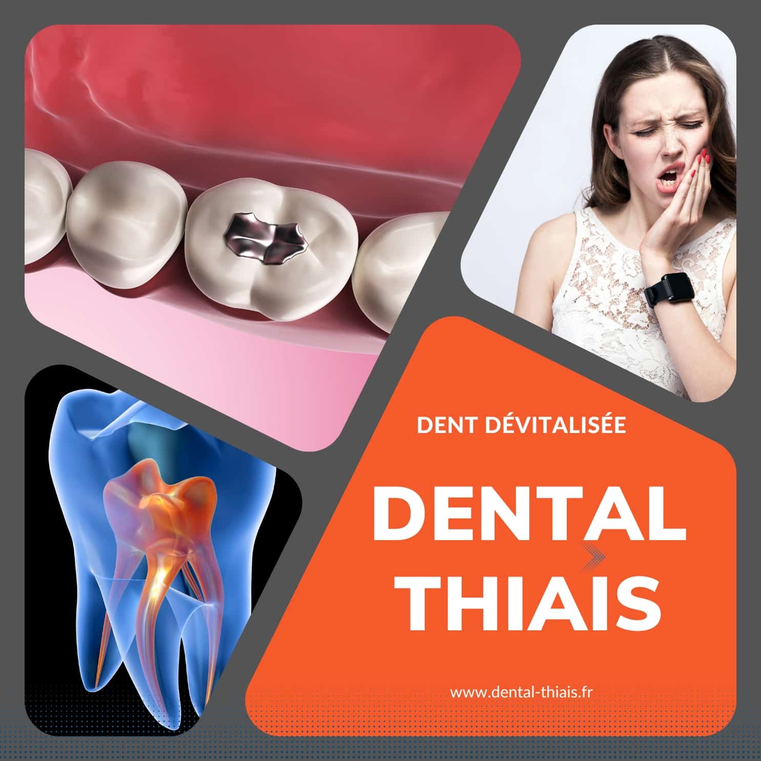 Les dents dévitalisées traitement, douleur et prévention